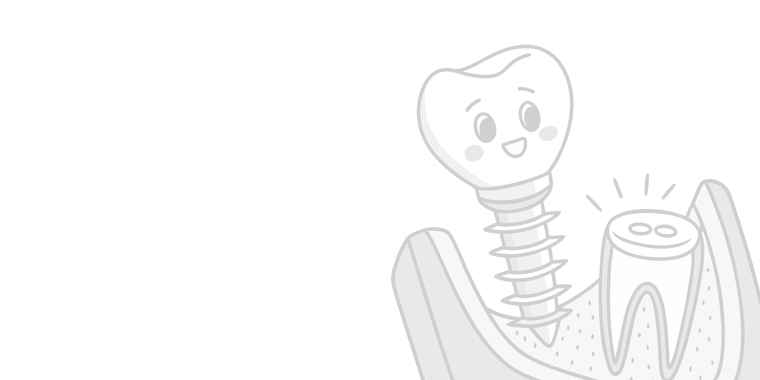 Implant Prosthetics