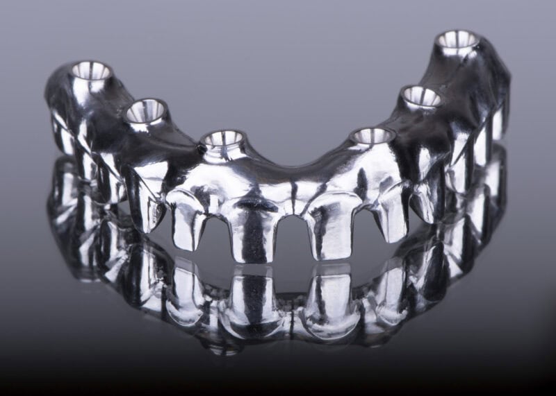 CAD:CAM milled titanium framework – Custom implant bar for fixed prosthesis