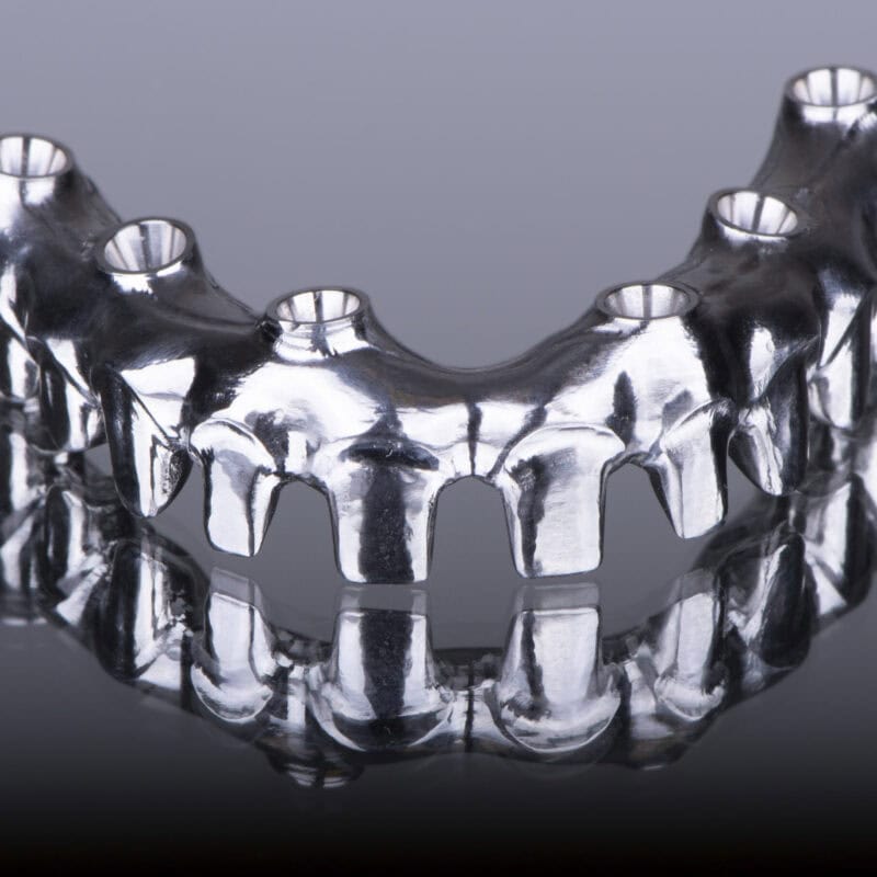 CAD:CAM milled titanium framework – Custom implant bar for fixed prosthesis