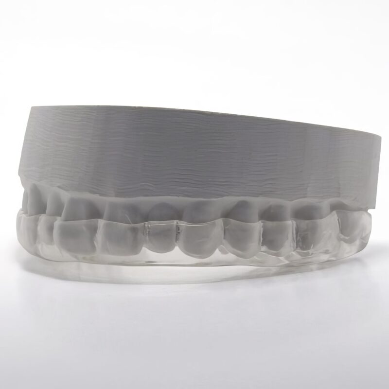 Custom-made bruxism night guard – Effective protection against teeth grinding and dental wear