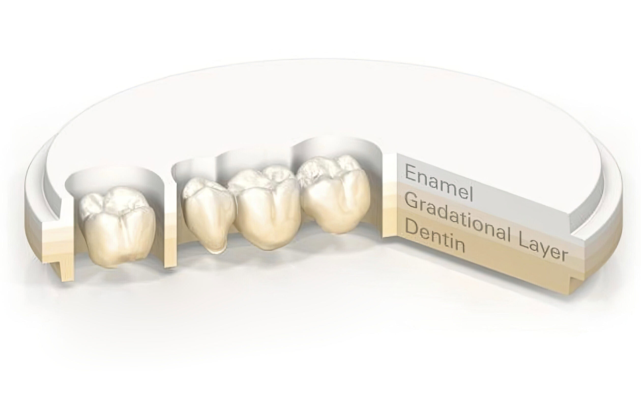 Full Multilayer Zirconia Crown – 100% Zirconia Dental Prosthesis, Translucent and Strong, for a Durable and Aesthetic Restoration 1