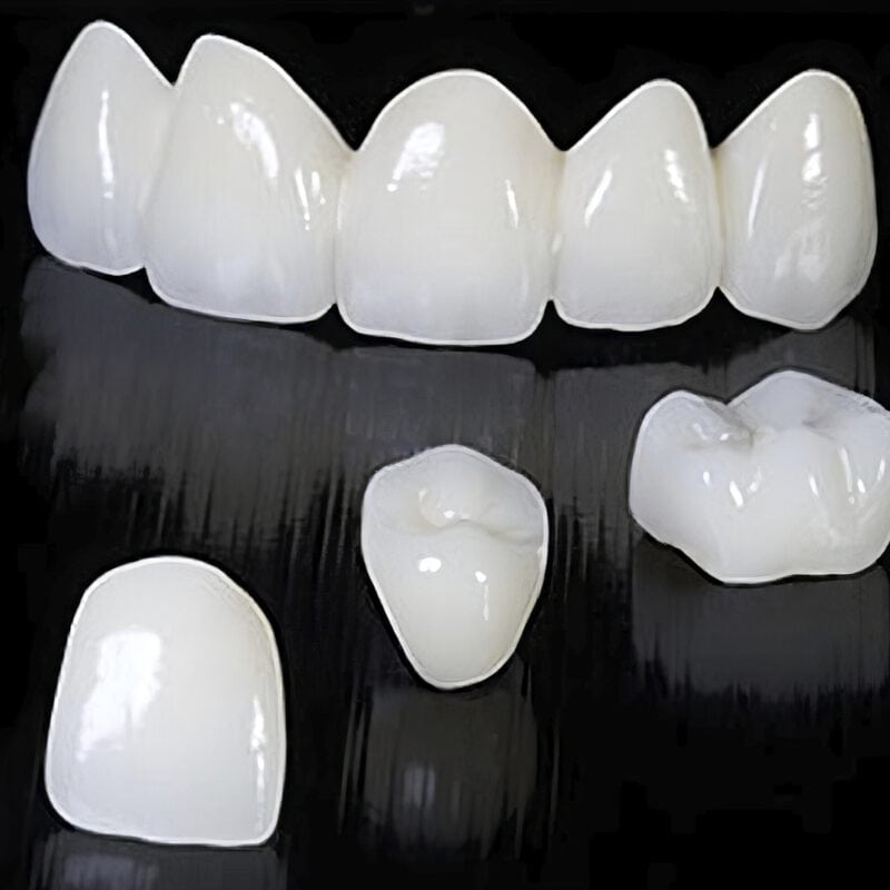 Full Multilayer Zirconia Crown – 100% Zirconia Dental Prosthesis, Translucent and Strong, for a Durable and Aesthetic Restoration 2