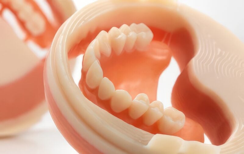 Fully digital milled complete dentures 2