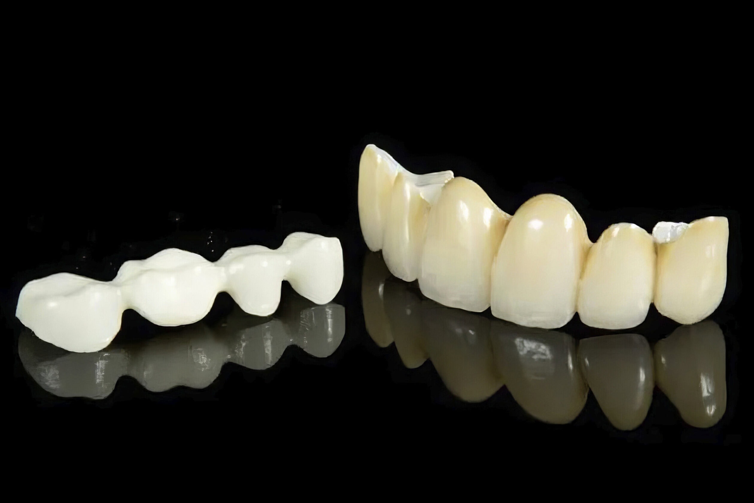 Layered Zirconia Crown – Premium Dental Prosthesis Combining a Zirconia Framework and Ceramic Layering for a Natural and Long-Lasting Result 1