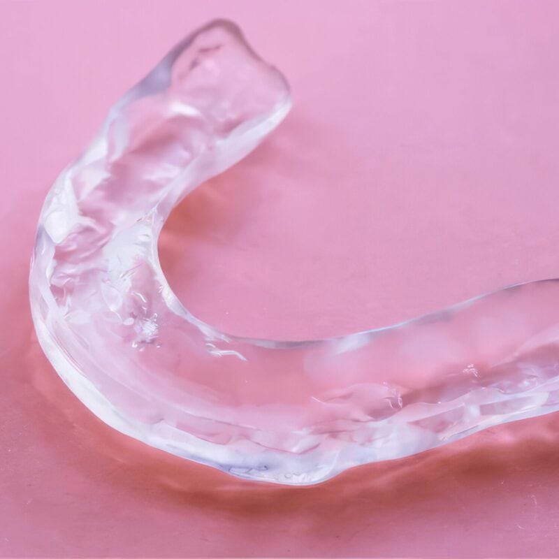 Occlusal thermoformed splint – Personalized solution to limit bruxism and relieve muscle tension
