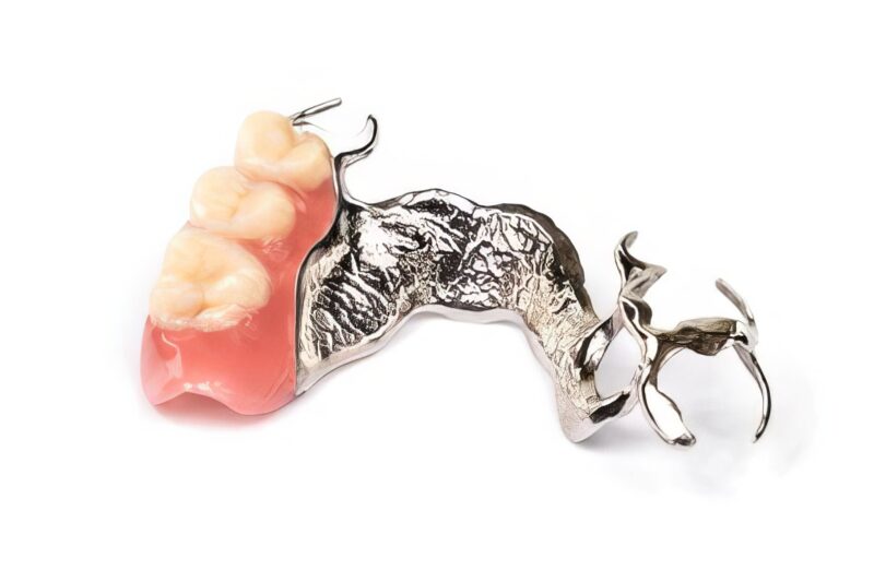 Removable dental prosthesis stellite metal-resin 2