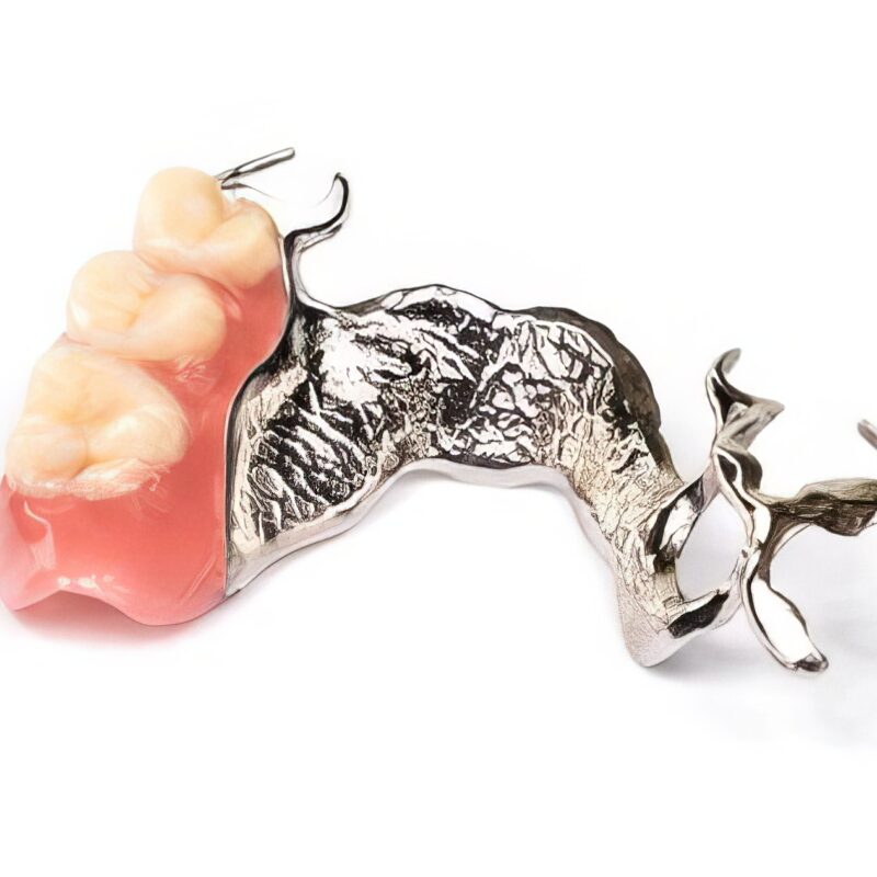 Removable dental prosthesis stellite metal-resin 2